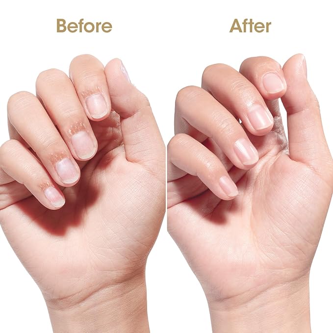 Gellen Nail Cuticle Oil for Growth and Strength, 15ml Vitamin E Nail Nourishing Oil for Hydrating, Moisturizing, Strengthening, Cuticle and Skin Care Product for Men Women, Jasmine Scent, Gold Shimmer