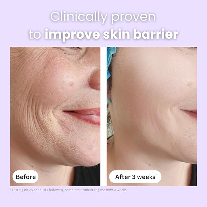 Organic Manuka Honey + Kanuka Oil Night Repair Face Moisturizer Cream | Rejuvenating, Calming, Restoring | 2.5 month supply, 2oz/60ml | Made in New Zealand