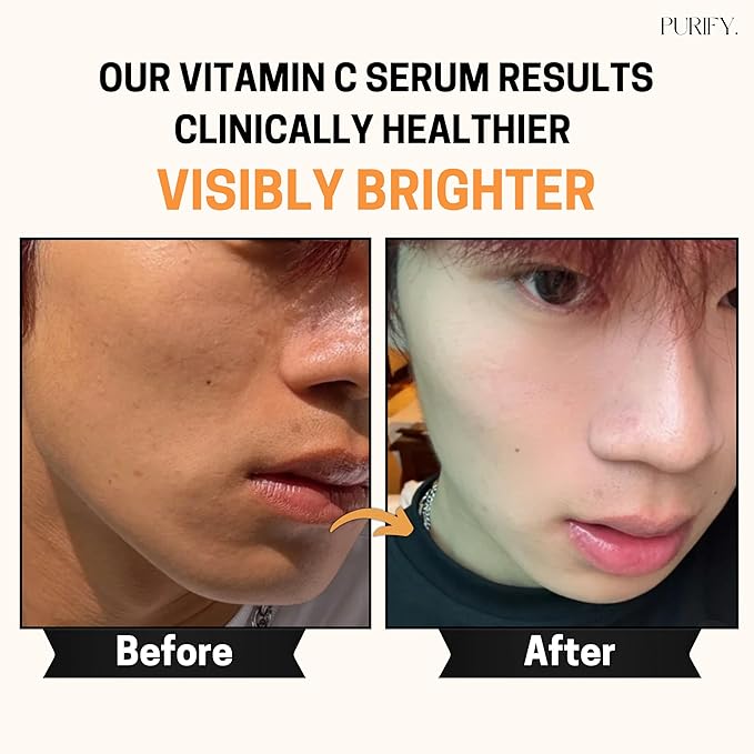 Purify 20% Vitamin C Serum - with Vitamin E & Ferulic Acid - Anti Aging - Brightening Face Serum - Pure Vit C for Dark Spots Correcting, Uneven Skin Tone, Wrinkles, Glow - 1 fl oz.
