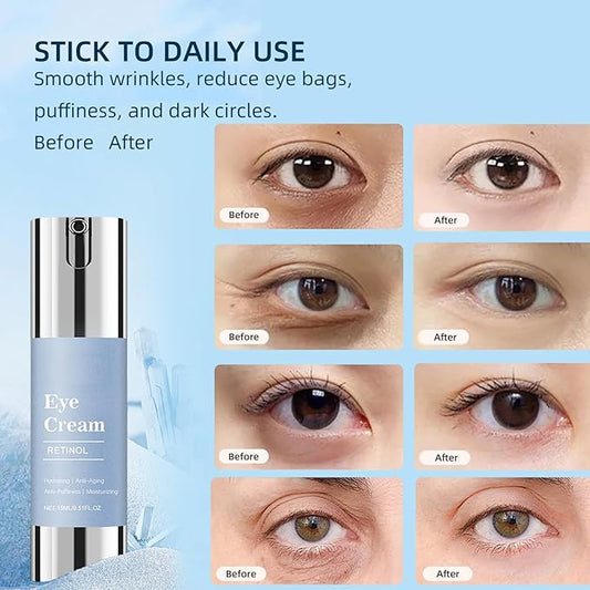 Retinol Under Eye Cream, Anti-aging Eye Cream for Eye Bags, Retinol Eye Cream for Dark Circles, Puffiness and Wrinkles, Suitable for all skin types (0.51 Fl Oz)