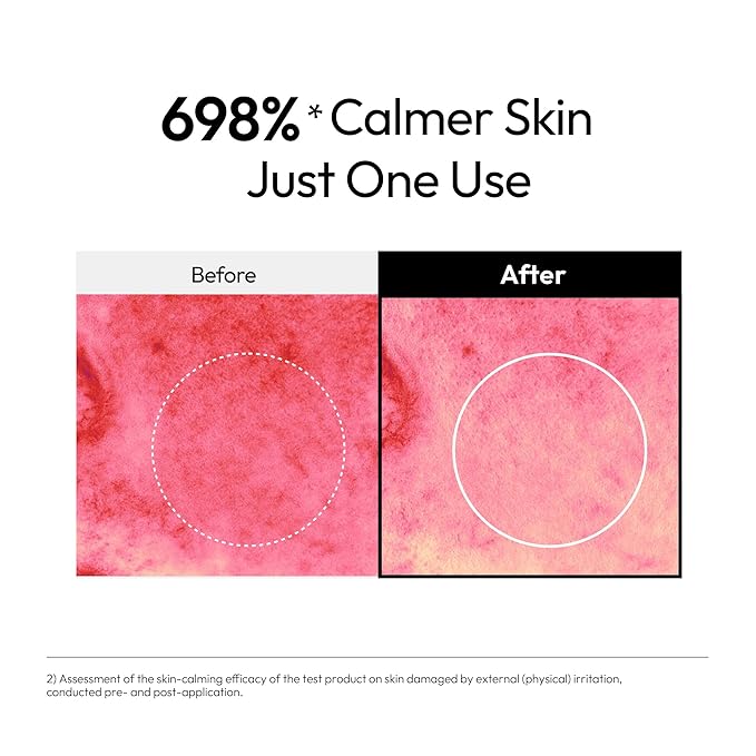 5% Panthenol Barrier Boost Serum – Hydrating & Soothing Korean Skincare with 4% Niacinamide, Madecassoside, 5 Ceramides & Mineral Water for a Stronger Skin Barrier (1.01 fl oz)