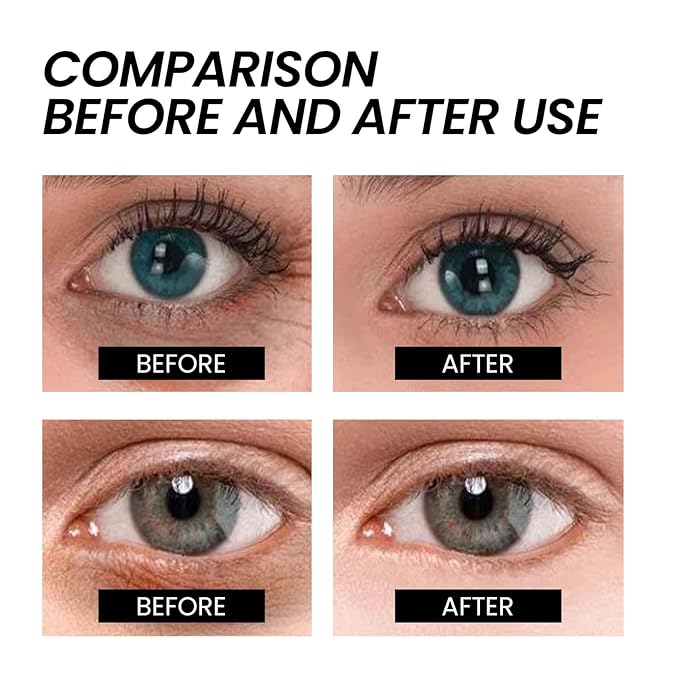 Instant Firming Eye Cream for Under Eye Bags and Puffiness,Dark Circles Treatment,Anti-Aging Eye Tightener,Temporary Face Lift,Reduces Fine Lines & Wrinkles (1)