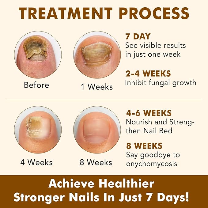 7 Day Ginger Nail Treatment 60ml, Nail Treatment, Nail Growth Serum, Ginger Nail Serum, Nail Nutrient Oil Strengthener Oil.