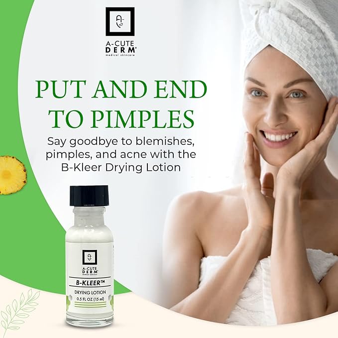A-Cute Derm B-Kleer Drying Lotion (0.5oz)