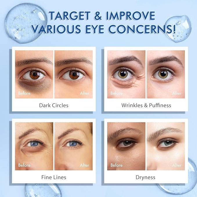 5% Caffeine Peptide Eye Serum, Under Eye Roller Cream for Dark Circles, Puffiness, Bags Under Eyes - 360° Massage Ball Cream for Wrinkles, Fine Lines and Firming (Blue)