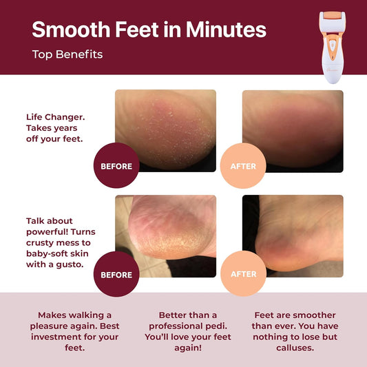 Rechargeable Callus Remover for Feet: Professional Electric Feet Sander for Women by Own Harmony - Electronic Foot File CR900 with 3 Rollers, Foot Grinder Pedi Care for Cracked Heels & Dry, Hard Skin