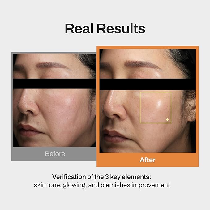 Yuja Vitamin C 20 Glow Serum - Korean Vitamin C Serum for Face with Yuja Oil - Dark Spot Correcting Glow Serum for Radiance, Enhancing Skin Clarity, and Improving Skin Tone and Elasticity -1.01 fl.oz