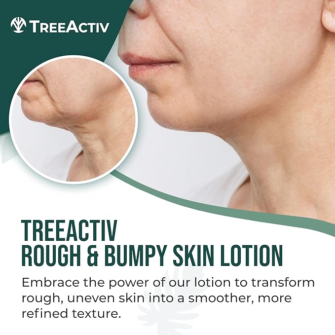 TreeActiv Rough and Bumpy Skin Lotion, 8 fl oz, With Hyaluronic Acid, Shea Butter and Vitamin E, Nourishing Lotion for Rough and Bumpy Skin, Moisturizing Strawberry Legs Treatment, For All Skin Types