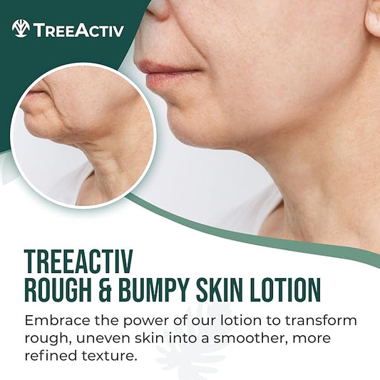 TreeActiv Rough and Bumpy Skin Lotion, 8 fl oz, With Hyaluronic Acid, Shea Butter and Vitamin E, Nourishing Lotion for Rough and Bumpy Skin, Moisturizing Strawberry Legs Treatment, For All Skin Types