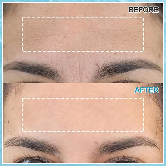 Forehead Wrinkle Patches 12pcs, Forehead Wrinkles Treatment, Overnight Face Wrinkles Patches for Women, Smooth and Soften Forehead Wrinkles & Lines,with Collagen, Aloe Vera,Vitaminer