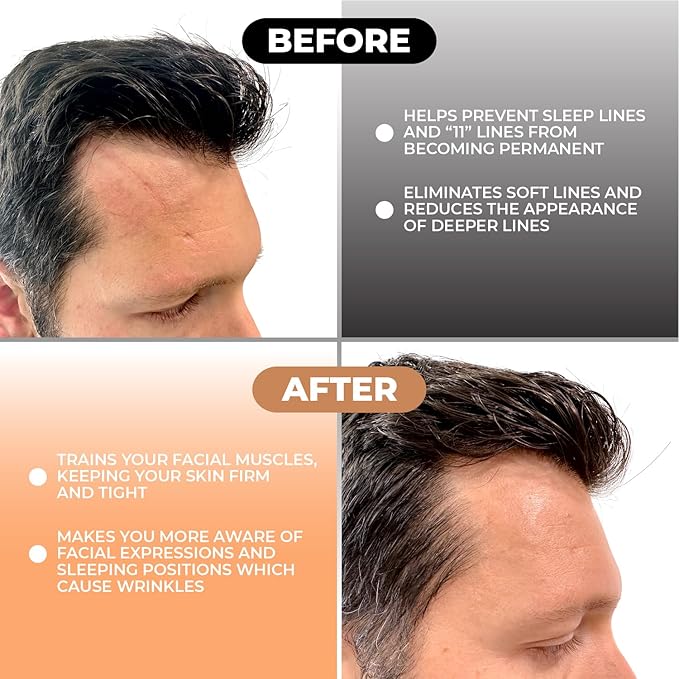 Forehead and Between the Eyes Wrinkle Patches - Hypoallergenic Facial Patches to Smooth & Soften Forehead Wrinkles & Eleven Lines - For Overnight Use, 160 Patches