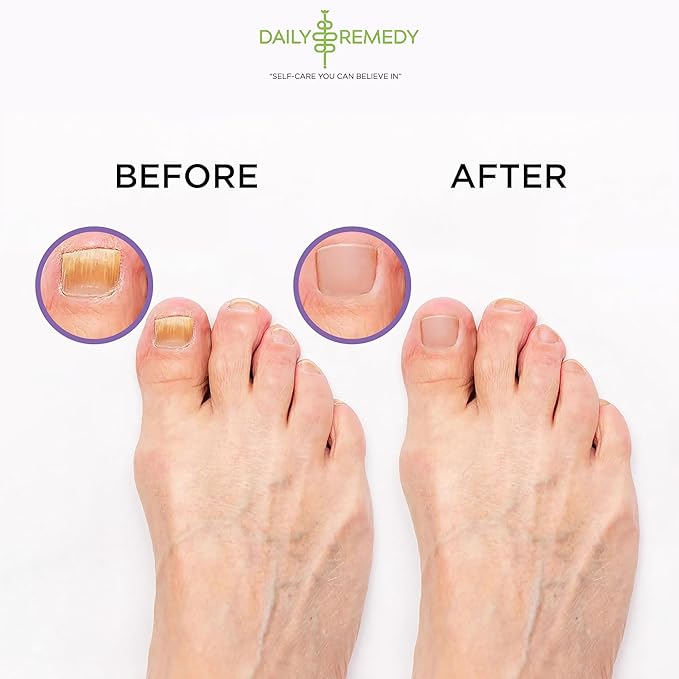 Daily Remedy Calming Lavender Foot Soak with Epsom Salt - 2 PACK -Foot Soak Soothes Sore Tired Feet, Athletes Foot & Remove Foot Odor. Best Foot Spa Pedicure Set