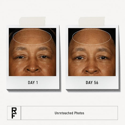 RODAN + FIELDS Redefine Overnight Reparative Lotion | Anti Aging Face Moisturizer for Fine Lines, Deep Wrinkles, and Firmness | With Peptides, Retinol, and Vitamin B3 | Lightweight Skin Care