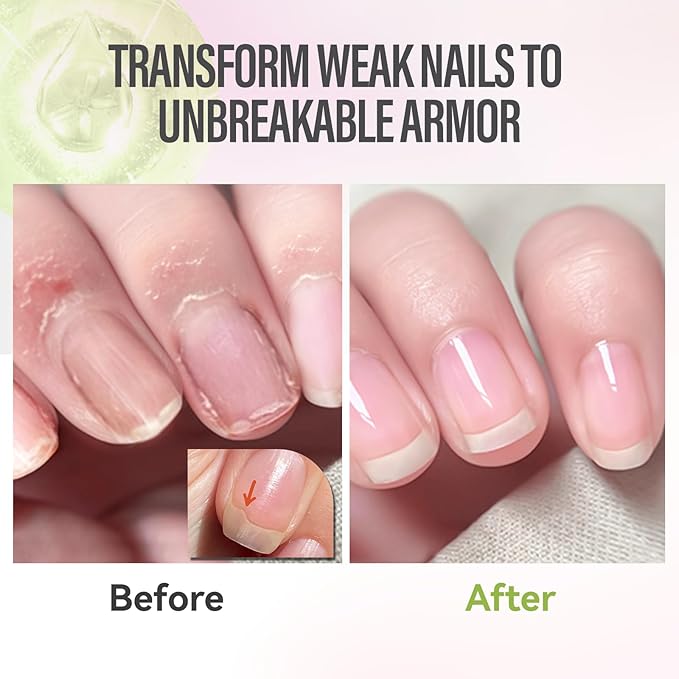 CHUCHU Nail Strengthener - Kiwi Scent Nail Repair Growth Moisturizing Treatment - Natural Jojoba Vitamin B & E Cuticle Oil for Dry Cracked Nails