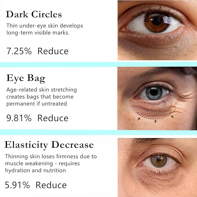 Retinol Eye Stick Balm, Retinol Eye Cream – Anti-Aging Formula Reduces Fine Lines, Dark Circles & Puffiness, Hydrates Delicate Skin – Visible Results in 4 Weeks, Gentle for Sensitive Skin