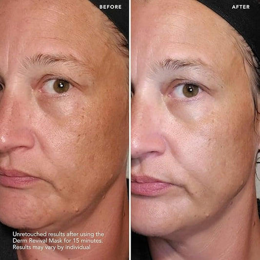 SK-II Brightening Face Mask - Derm Revival Sheet Mask to Improve Radiance, Skin Texture & Dark Spots - Anti Aging Face Mask Enriched with Pitera, Vitamin C & Niacinamide (10 Count)