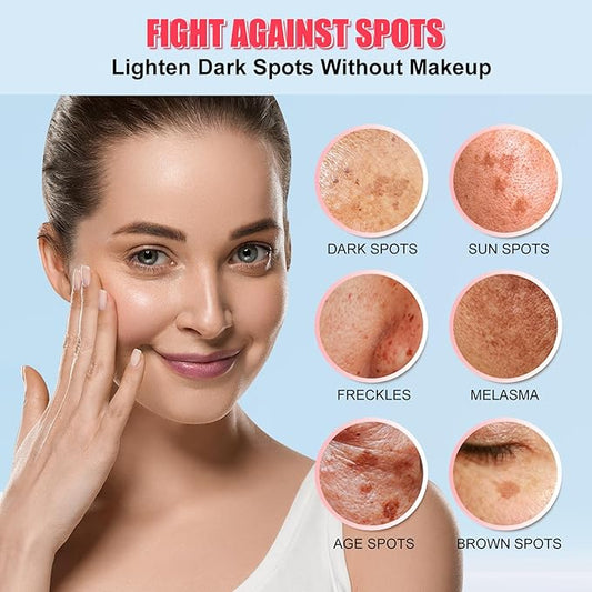 Dark Spot Corrector for Face and Body - Serum, Corrects Sun Spots, Freckles and Melasma - 1.7 Fl Oz