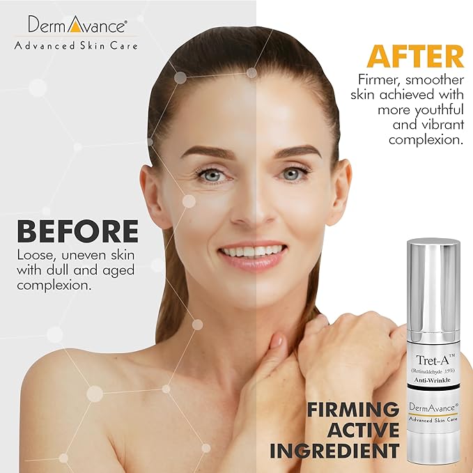 Tret-A Anti Aging Face Cream - Retinaldehyde 0.15% Lotion for Advanced Anti-Aging and Radiance - Face Lotion for Women - Facial Anti-Wrinkle Care 15ml