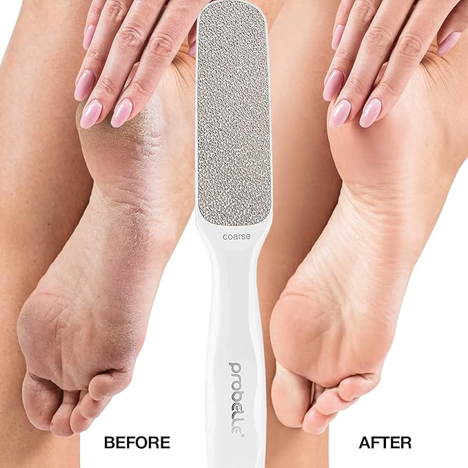 Probelle Double Sided Multidirectional Nickel Foot File Callus Remover - Immediately Reduces calluses and Corns to Powder for Instant Results, Safe Tool (White)