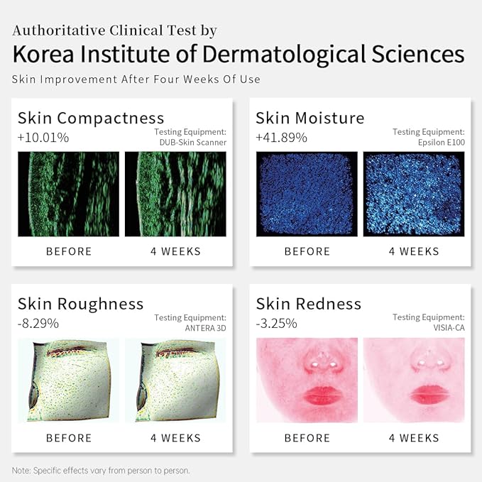 LED Face Mask, 8 Color LED Mask for Face Skin Care, FSA/HSA Eligible, Red Light Mask for Face, Infrared, Red & Blue Light Mask, Wrinkle Reduction, Wireless. (Miracle ACE RB-050)