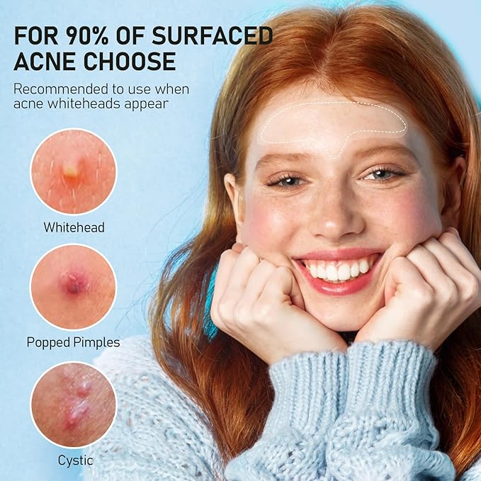 Large Pimple Patches for Face, Hydrocolloid Acne Patches, Zit Patches for Large Troubled Face, Chin, Back Blemish Patches Acne Spot Treatment Blemish Patches Pimple Stickers