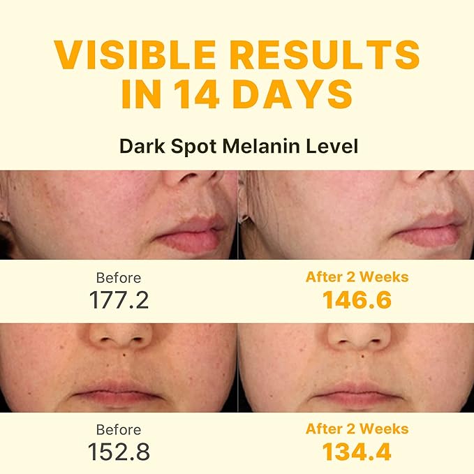 14-Day Vita Facial Ampoule | Vegan Discoloration Correcting Serum w/Niacinamide & Glutathione | Dark Spot Corrector Face Serum to Even Skin Tone & Reduce Hyperpigmentation (1.01fl oz)