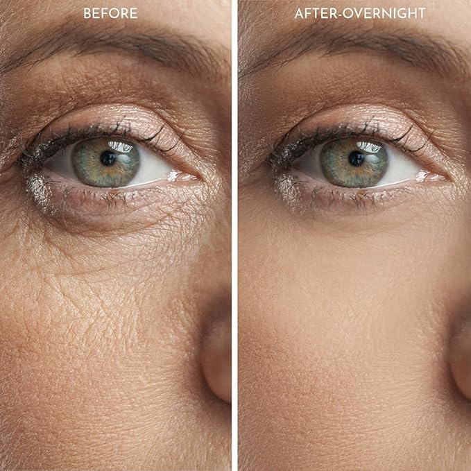 20X Reusable Expression Line Smoothing, Medical-Grade Silicone for Overnight Wrinkle Reduction & Anti-Aging Hydration, Beautify Brow Lift Forehead Anti-Wrinkle Patch