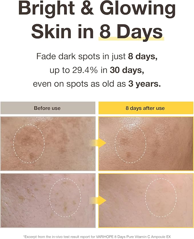 8 Days Pure Vitamin C Toner (3.5oz) - Hydrating, Mildly Acidic, Soothing Toner. Korean Skin Care. Stabilized Vitamin C, Kakadu Plum, Beta-Glucan.