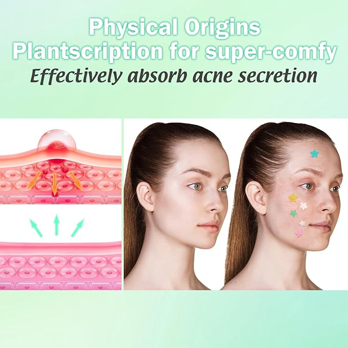 Star Pimple Patches For Face 240 Counts Hydrocolloid Acne Patches with Tea Tree Oil Blemish Zit Patches For Face 3 Sizes Acne Patch Acne Dots Patches 6 colors Pink Yellow Blue Star Pimple Patches