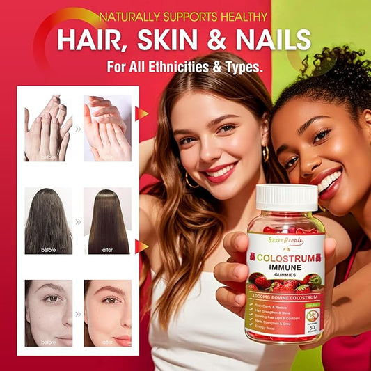 2 Pack Colostrum Supplement Gummies for Women & Men, with Biotin 10000mcg, Collagen, Grape Seed, Vitamin A, D3, B1 for Hair Skin Nails,Immue Support, Sugar-Free, 60 Day Supply
