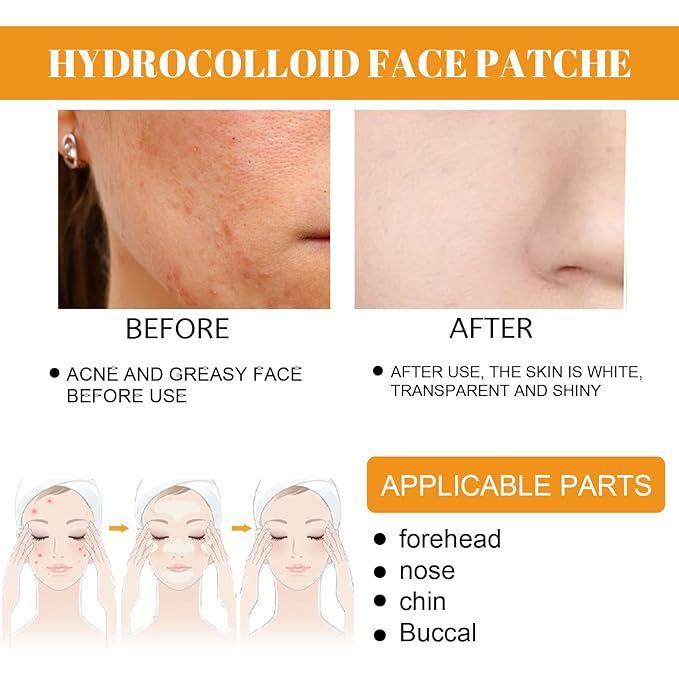 40Pcs Hydrocolloid Acne Patches Full-Face Coverage Kit for Pimples & Blemishes, Skin Care Solution for Clearing Spots