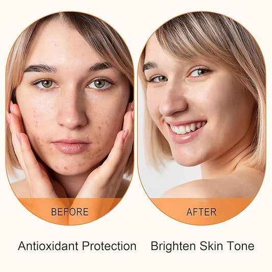 Vitamin C Serum for Face with Hyaluronic Acid – 1.5ml x 30PCS, Brightening Hydrating Facial Serum, Travel Size Skincare for Glowing Skin(1.52 Fl Oz (Pack of 1))