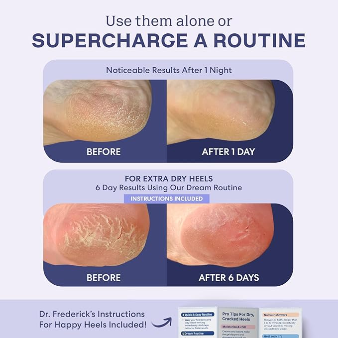 Dr. Frederick's Original Moisturizing Fuzzy Heel Socks - 2 Pairs - Cozy Gel-Lined Sleep Socks for Women & Men - Soothes Dry, Cracked Feet - Heel Repair - Lilac Leisure