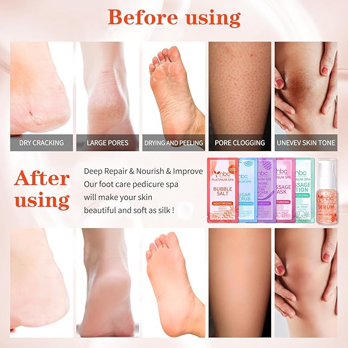 Pedicure Foot Soak Set - Upgraded 6 in 1 Foot Spa, Foot Bath Spa, Pedicure Kit, Foot Soak for Tired & Dry Cracked Feet, Athletes Feet, Bad Odor, Softens Calluses (Tropical fruit)