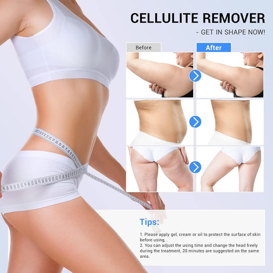 sens for Improvement in The Appearance of Cellulite Device Cellulite Massager Radio Frequency, White