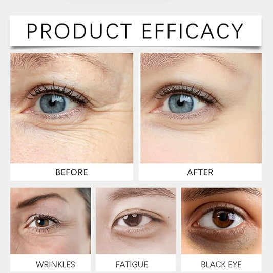 Dinkiss Lutein Eye Essence Oil, Vitamin C Lutein Eye Essence Oil, Improve Bags and Dark Circles, for Women Men (1, 3 pcs)