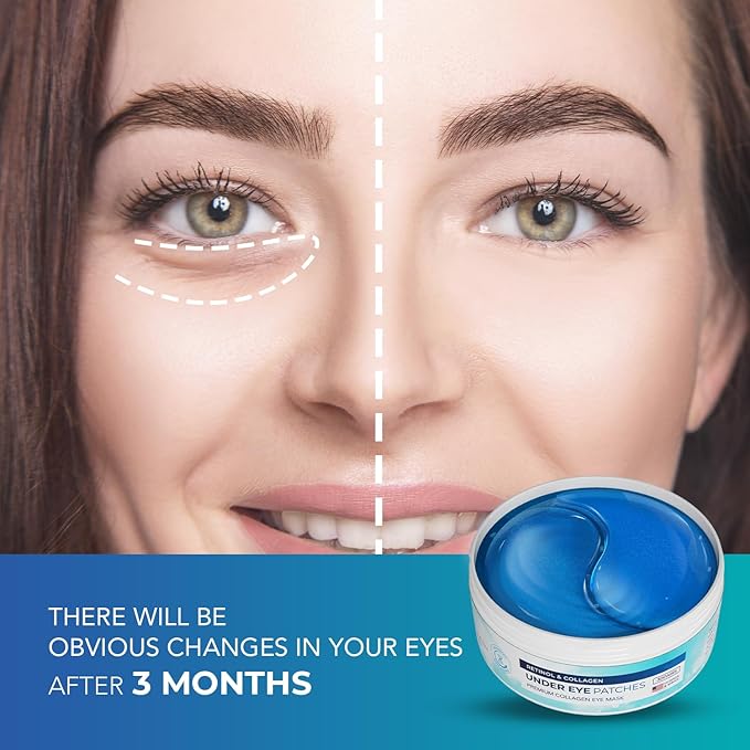 Under Eye Patches for Dark Circles: Under Eye Mask for Wrinkles - Eye Bags - Fine Lines - Puffy Eyes - Gel Mask - Amino Acid - Hydrolyzed Collagen - Anti Wrinkle Patches - Blue Eye Patches - 30 Pairs