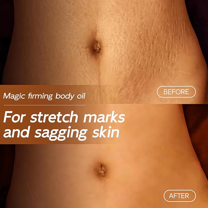 Magic Body Firming Oil, 3.38 FL OZ, Korean Skin Care Post-Shower Body Oil for Women – Natural, with Jojoba Oil to Tighten, Hydrate & Nourish Dry Skin, Lightweight & Non-Greasy for Full Body Use