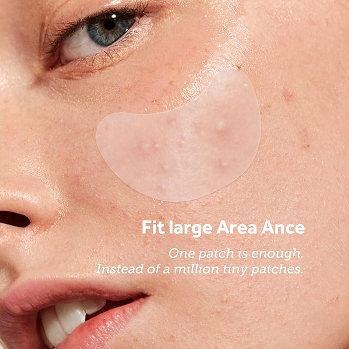 Pimple Patches (6 Sizes 138 Patches), Acne Patches for Large Zit Breakouts, Hydrocolloid Bandages for Face, Chin, Nose, Forehead, Body, Back, Neck & Chest, Oval Hydrocolloid Acne Patches