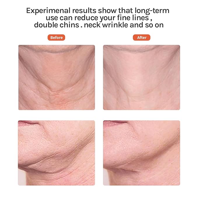 Ms.W Red Light Facial Massager, Face Massager Tool for Skin Care with LED, Thermal, and Vibration,Tightenings and Rejuvenation for Face and Neck