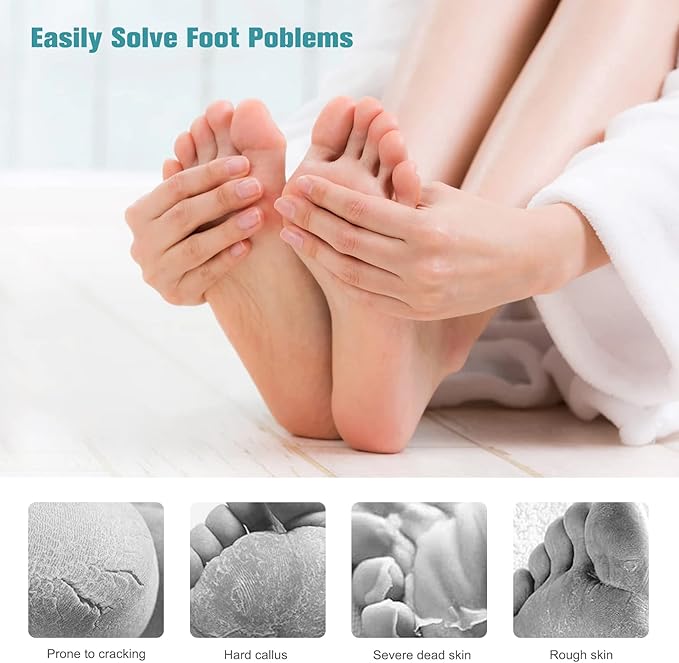FVION Foot File Callus Remover Cracked Heel Shaver – Double Sided Pedicure File/Foot Scraper for Wet and Dry Feet