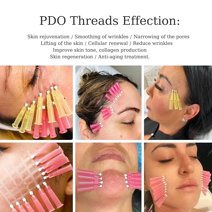 elves Pdo Threads for Face Lift & Whole Body Lifting, Pdo Mono Threads 29G38mm 20Pcs