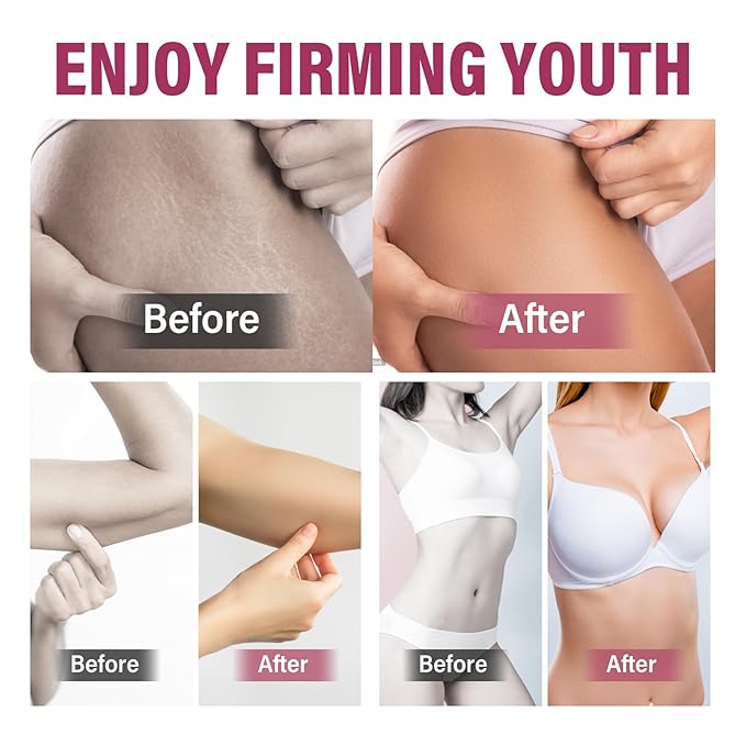 Yakitoko Body Firming Oil, Hydrating and Firming Skin Oil for Arms, Chest, Thighs and Tums, Gentle Formula, Quick Absorption, Suitable for Full Body Use