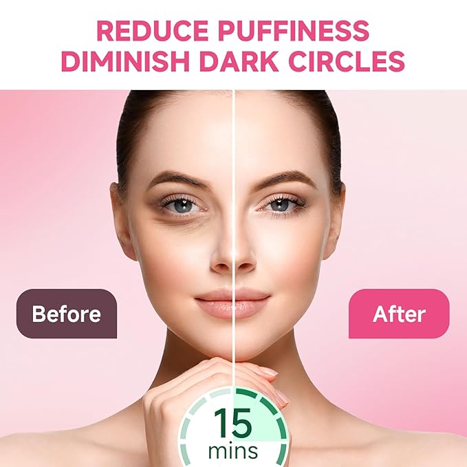 POSTA 20Pairs/40Pcs Collagen Under Eye Patches, Glitter Under Eye Mask for Dark Circles and Puffiness, Hydrating Eye Skincare Reduce Wrinkles and Fine Lines, Eye Gels Pads for Beauty Personal Care