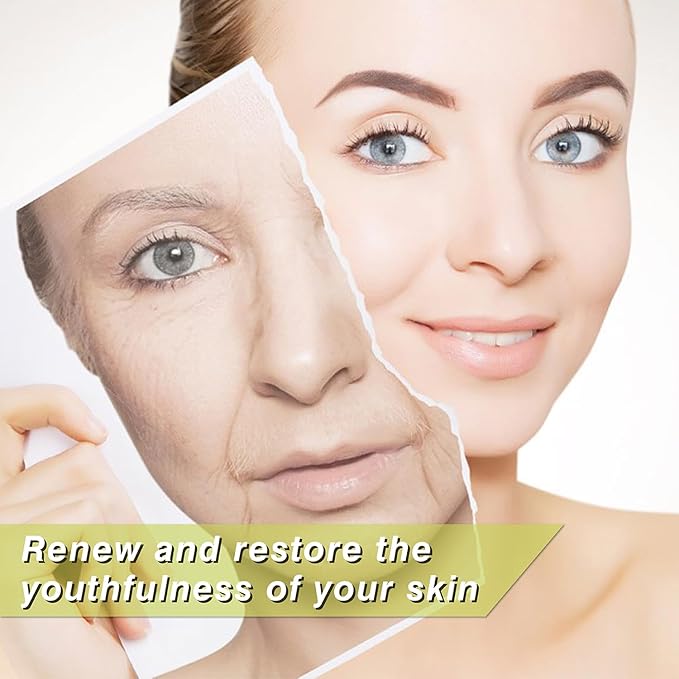 elves pdo threads eye mono - pdo thread lift eyes bullet blunt type, 30G25mm, 40 pieces