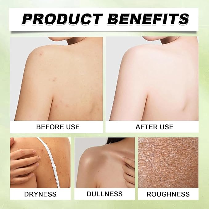 Neuropathy Mama Oasis Lotion,Neuropathy Magnesium Cream For Neuropathy Magnesium Body Butter Deeply Moisturizes Skin, Neuropathy Cream Magnesium,Keep Soft Smooth