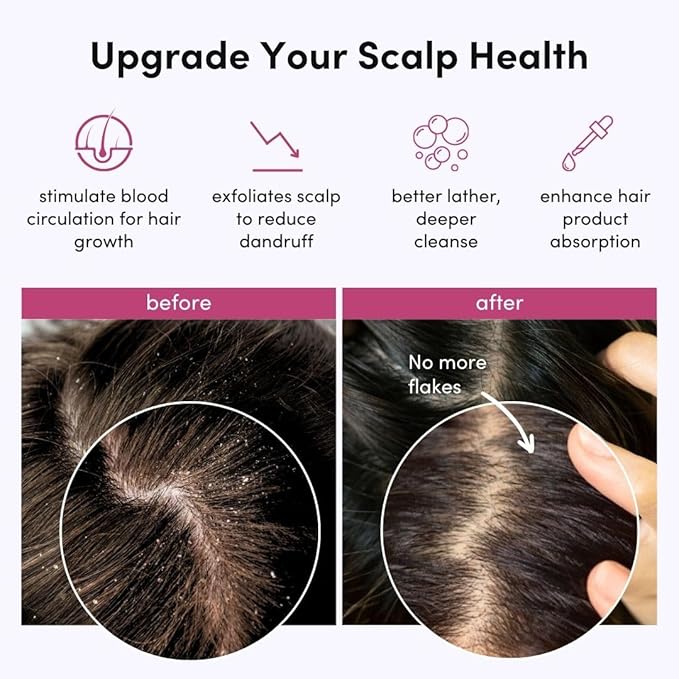 Fancii Hair Scalp Massager, Shampoo Brush for Wet & Dry Hair, Scalp Scrubber Exfoliator for Dandruff Removal & Hair Growth. Shower Head Brush for All Hair Types, Soft Silicone (Black)