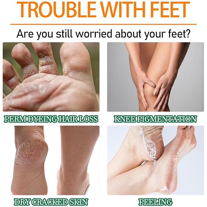 Foot Peel Spray Orange Oil,Refreshing and Moisturizing Foot Exfoliating Cleansing Spray for All Skin Types,Instant Foot Peeling Spray to Remove Dead Skin