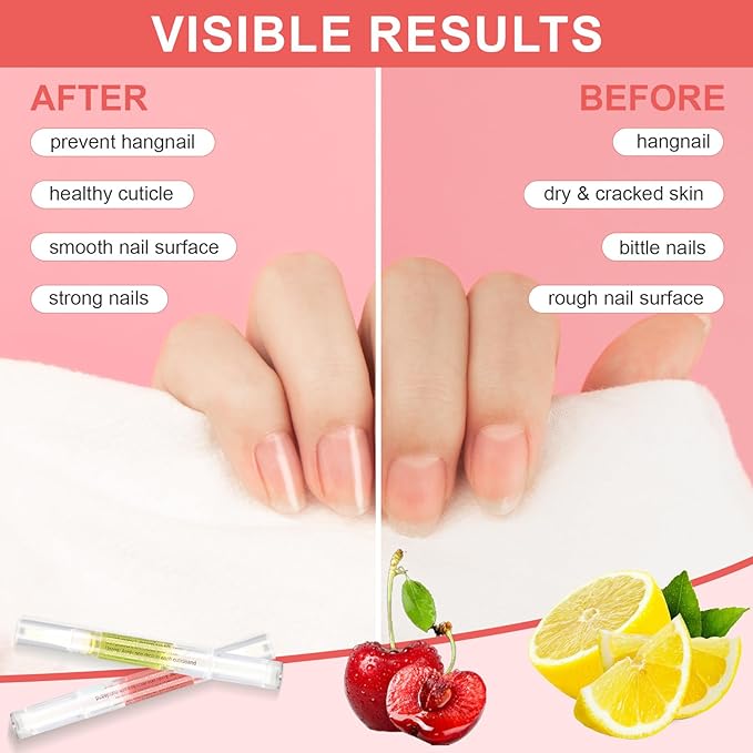Meschett 3PCS Nail Cuticle Oil Pens with Nail File, Cuticle Oil for Nails from Natural, Nail Oil Cuticle for Cracked and Dry Nail(Lemon & Lily & Cherry Flavor)