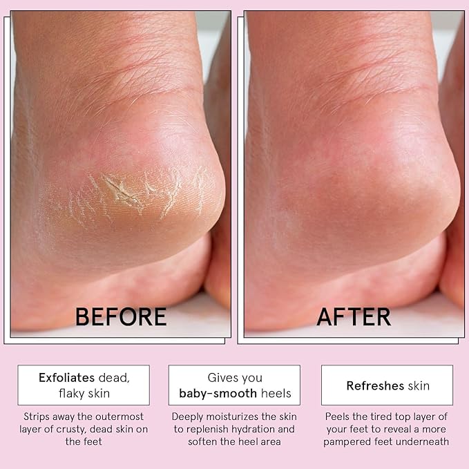 grace & stella Award-Winning Foot Peel Mask - Foot Peeling Mask with Aloe Vera - Moisturizing Foot Mask for Dry Cracked Feet - Foot Exfoliator for Baby Soft Feet (4 Pairs, Lavender)